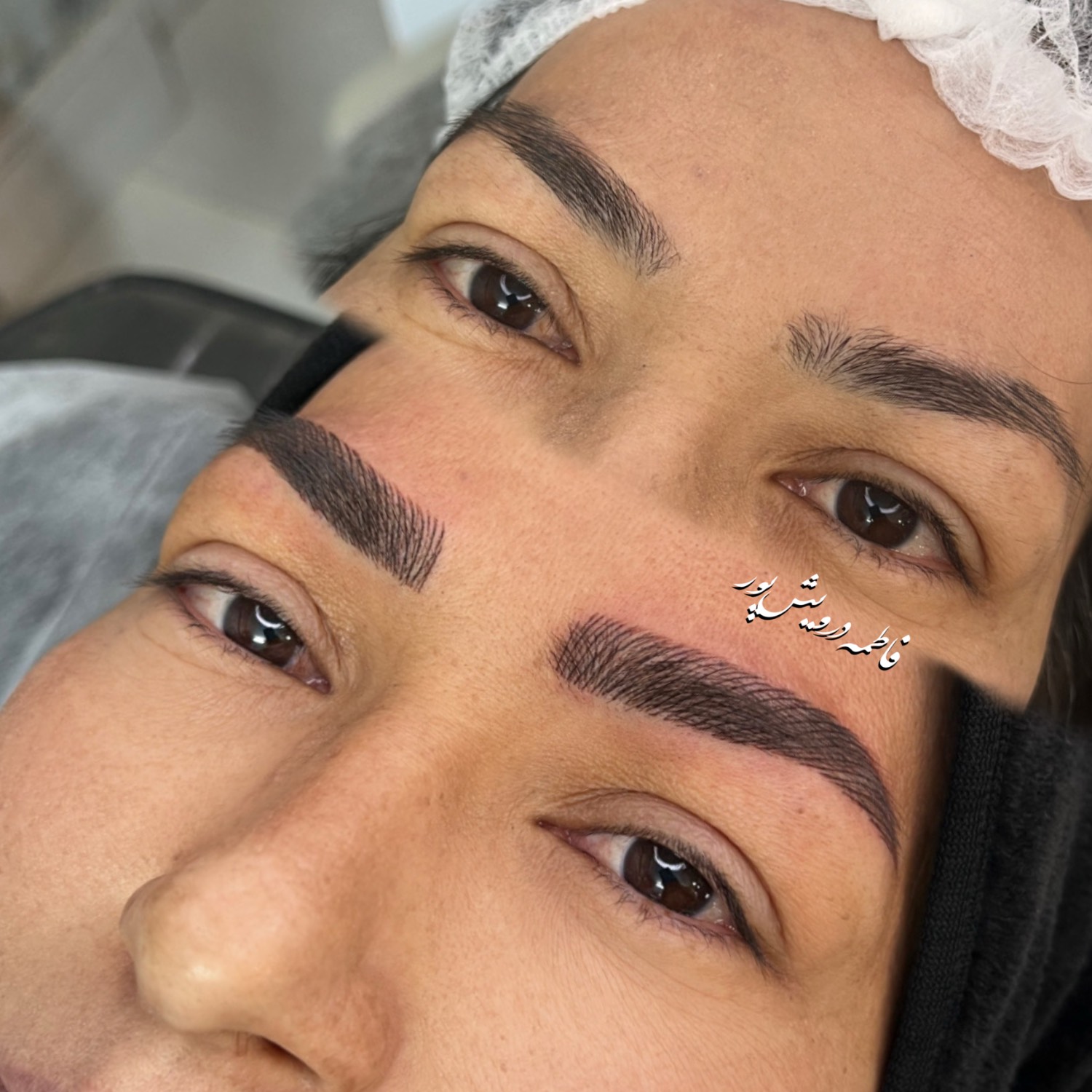 نمونه کار فیبروز ابرو نچرال در مشهد