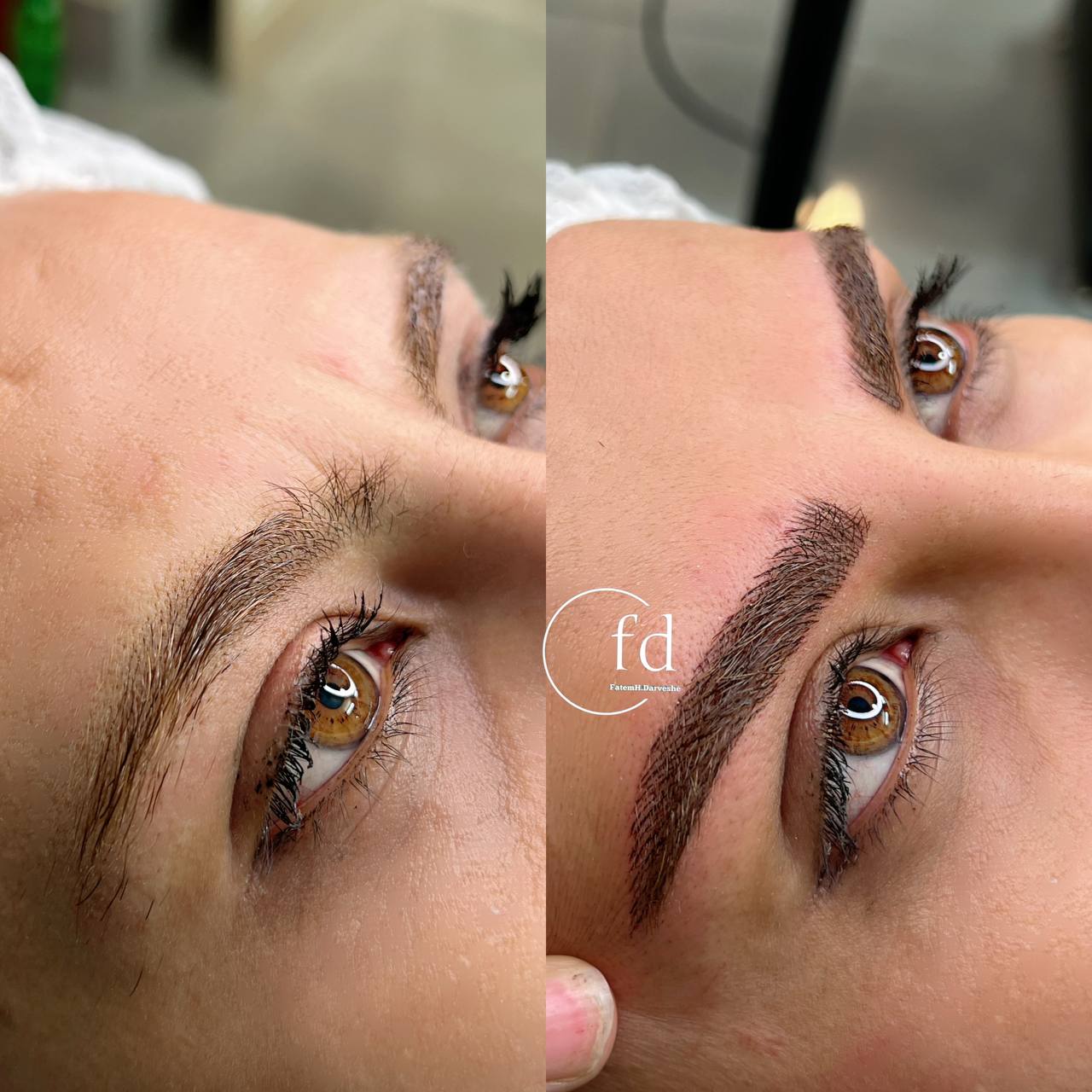 مقایسه کاشت ابرو و میکروبلیدینگ